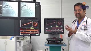 OCT Angiography Optical Coherence Tomography OCT Technology for Coronary Imaging in Angioplasty [upl. by Ecenaj26]