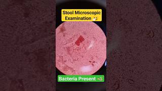 Stool test  Stool microscopic examination  Stool microscopy microbiology shorts trending viral [upl. by Anaert537]