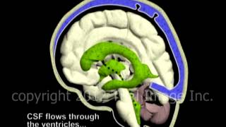 Hydrocephalus and Cerebrospinal Fluid CSF circulation by Dr Cal Shipley MD [upl. by Ekez]