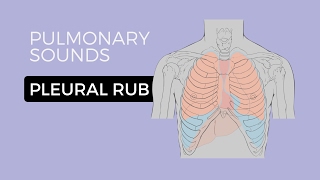 05  Lung Sounds  Pleural friction rub 🎧 [upl. by Nohsav50]