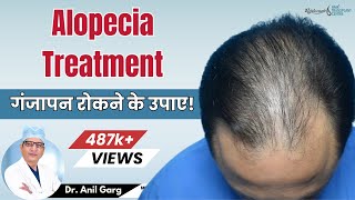 Alopecia Treatment For Men and Women  गंजापन रोकने के उपाए  Dr Anil Garg [upl. by Dierdre481]