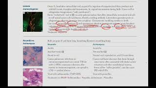 Listeria Monocytogenes Nocardia vs Actinomyces  Microbiology  13  First Aid USMLE in UrduHindi [upl. by Burwell]