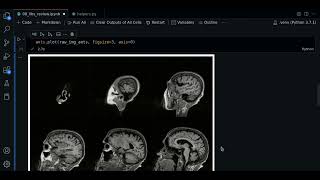 00  ANTsPy review  Course MRI preprocessing with Python [upl. by German]