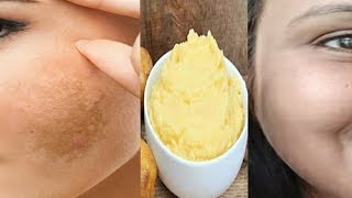 pigmentation home remedy get clear Spotless skin with this remedy kaurtips [upl. by Tarah349]