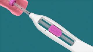 IUD Insertion Video [upl. by Letsou630]