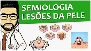 Semiologia 10  Lesões elementares da pele Vídeo Aula [upl. by Lilhak]