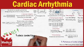 Antacids Mnemonic for Nursing Pharmacology NCLEX [upl. by Irrahs]