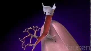 Bronchitis Animation [upl. by Imelda]