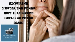 Excoriation DisorderSkin Picking More Than Popping Pimples or picking scabs [upl. by Bilat896]