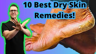 How to Remove Thick Dead Skin from Feet 1 BIG SECRET [upl. by Shepp]