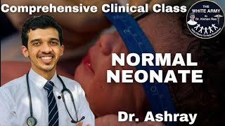 Normal Neonate case presentation [upl. by Dorcea]