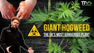 Giant Hogweed  The UKs Most Dangerous amp Toxic Plant [upl. by Nifled]