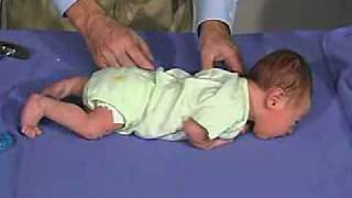 physical exam Newborn Normal Positions  Prone [upl. by Yam]