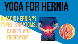 Yoga For Hernia Patients  हर्निया के लिए योग अभ्यास  Yoga Poses For Inguinal Hiatal Hernia 🙏 [upl. by Selmner]