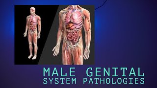 TESTICULAR NEOPLASMS seminomas and nonseminomas lecture 5 of Male genital system pathology [upl. by Fredia]