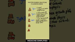 Salter Harris Classification  Salter Harris Fracture Classification  Type 12345 medicine [upl. by Amrac]