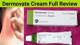 Dermovate Cream Review Benefits Side Effects And Uses  Cream For Eczema [upl. by Ardnued]