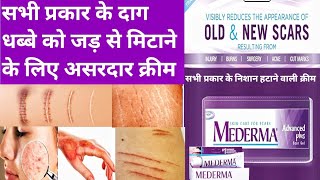 Mederma advanced Plus scar gel review how to remove burn marks acne marks stretch marks cut marks [upl. by Kcirderf]