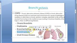 Pathology 481 a Bronchiectasis dilation obstruction foul smell sputum cough respiratory Kartagener [upl. by Amaral]