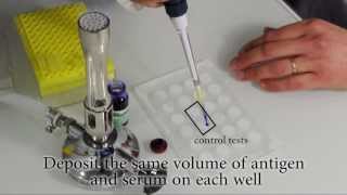 How to perform a Rapid Slide Agglutination Test [upl. by Ham]