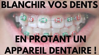 Comment Blanchir Vos Dents en Portant Un Appareil Dentaire [upl. by Asiluj]