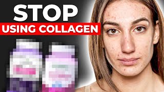 Collagen Is Detrimental To Your Health Youth And Strength  Debunking the Myths [upl. by Giesecke408]