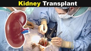 What are the signs of kidney disease [upl. by Hras106]