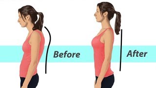 Cervical Spine Stretches for TMD Neck Pain and Posture [upl. by Tedda]