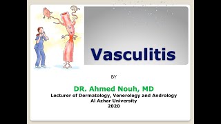 Vasculitis for Arabic students [upl. by Dickman317]