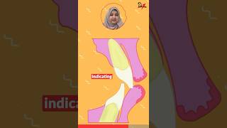 Dentist Tips Correcting Maxillary Incisor Length Easily drteeth fullmouthrehabilitation [upl. by Ekusuy]