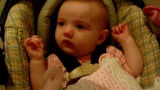 Infantile spasms infant seizures [upl. by Cogen]