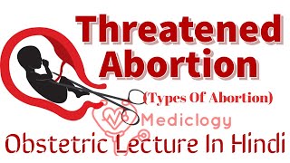 Threatened AbortionBleeding In Pregnancy  Types Of Abortion Lecture 2Full Lecture In Hindi [upl. by Latsirk]