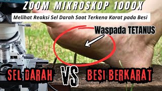 Zoom 1000X Melihat Reaksi Darah saat terkena Besi Berkarat [upl. by Oznohpla]