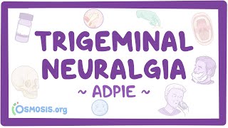 Trigeminal neuralgia Nursing Process ADPIE [upl. by Rik]