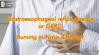 GERD treatment Acid reflux in nose and throat Burning in nose amp Throat Dr Muralidhar S Kathalagiri [upl. by Farmelo721]