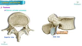 Anatomy of Lumbar vertebrae Osteology USMLE  Typical and Atypical lumbar vertebra [upl. by Kelsey57]