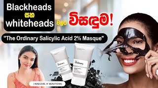 Quick amp easy way to remove BLACKHEADS amp WHITEHEADS ඉක්මන් සහ නිවැරදිම ප්‍රතිකාරය [upl. by Ritch840]