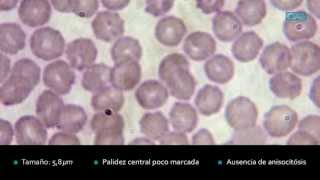 ‪Hematología Serie roja equina normal CIAB wwwciabes‬ [upl. by Elacim457]