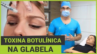 Botox®  Toxina Botulínica na Glabela [upl. by Azitram]