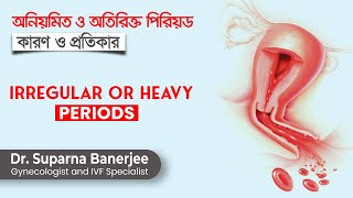 Irregular heavy periods Causes amp Treatment  অনিয়মিত ও অতিরিক্ত পিরিয়ড এর কারণ ও প্রতিকার [upl. by Cosmo]