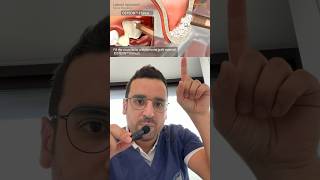 GREFFE dentaire  le clé du sinus lift avec implant [upl. by Darin]