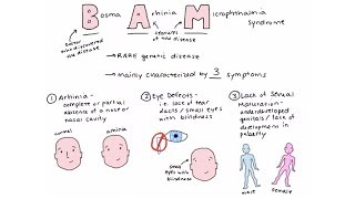 Bosma arhinia microphthalmia syndrome BAM syndrome [upl. by Nonnad]