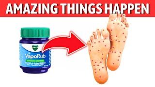 Rub VICKS VapoRub on Your Feet and Feel the Magic Happen [upl. by Akimert]