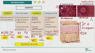 Cirugía plástica y cabeza y cuello  Quemaduras [upl. by Inamik588]