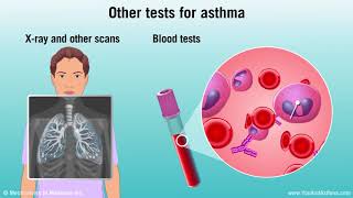 Diagnosing Asthma Mild Moderate and Severe [upl. by Pacien541]