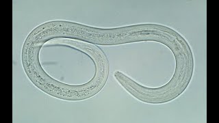 Ancylostoma اكثر انواع الديدان المسببة للانيميا وتعرف باسم الديدان الخطافية [upl. by Latreshia233]