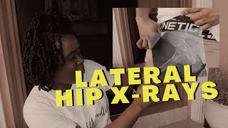 Lateral Hip Xray Positioning amp Centering Tips w Demo  Ask The Rad Tech [upl. by Ayotas]