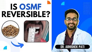 IS OSMF REVERSIBLE [upl. by Nolak]