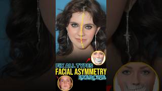 Fix Asymmetrical Face [upl. by Nat]