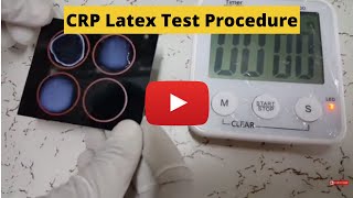 CReactive Protein Test CRP Latex Test Procedure [upl. by Cynera]